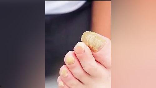 修脚视频,跟随视频学习专业修脚技巧