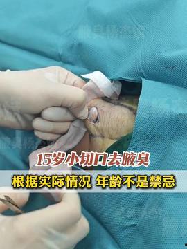 狐臭手术视频,专业视频带你了解祛除狐臭的奥秘