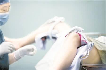 女性人工流产视频,视频背后的真实故事