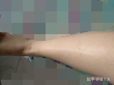 女生下面脱毛视频,揭秘女生私密脱毛视频全解析