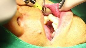 口腔视频,揭秘日常口腔护理秘诀