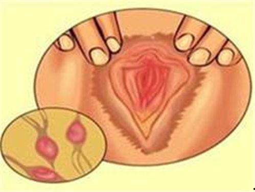 少女阴道视频,阴道视频引发的争议与反思
