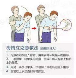 海姆立克急救法的标准动作视频,关键时刻的救命技能演示